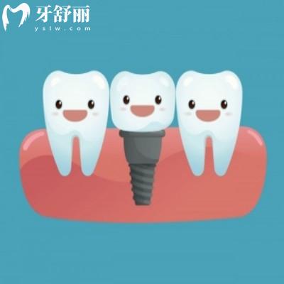 洛陽牙科醫(yī)院哪家好?安排看牙好的口腔診所及收費價目表