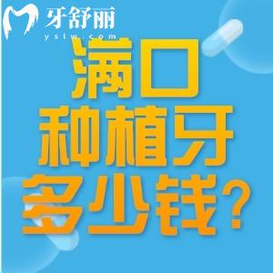 滿口種植牙大概多少錢?查詢老人全口假牙價(jià)目表可知3-20w不等可選活動(dòng)假牙