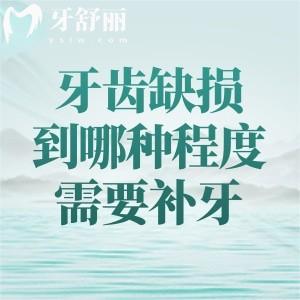 牙齒缺損到哪種程度需要補牙？材料怎么選？2025全新補牙價格全解析！